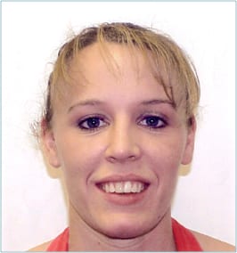 Headshot of a patient before her dental work had been completed, revealing some flaws in her smile.