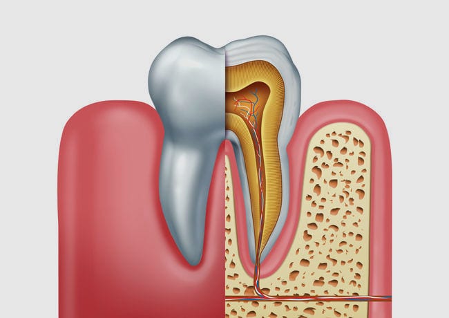 An infographic reveals the inside of a tooth and gums, which also shows root canal nerve endings.